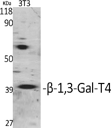 Fig. Western Blot analysis of various cells using β-1, 3-Gal-T4 Polyclonal Antibody. Secondary antibody (catalog#: A21020) was diluted at 1:20000.