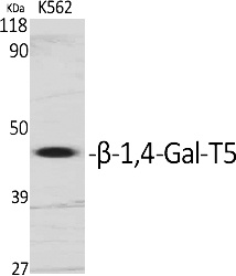 Fig.1. Western Blot analysis of various cells using β-1, 4-Gal-T5 Polyclonal Antibody diluted at 1:1000. Secondary antibody (catalog#: A21020) was diluted at 1:20000.