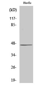 Fig.2. Western Blot analysis of 293 cells using β-1, 4-Gal-T5 Polyclonal Antibody diluted at 1:1000. Secondary antibody (catalog#: A21020) was diluted at 1:20000.