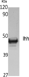 Fig. Western Blot analysis of extracts from NIH-3T3 cells, using Ihh Polyclonal Antibody. Secondary antibody (catalog#: A21020) was diluted at 1:20000.