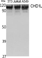 Fig. Western Blot analysis of extracts from NIH-3T3, Jurkat, A549 cells, using CHD1L Polyclonal Antibody. Secondary antibody (catalog#: A21020) was diluted at 1:20000.