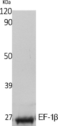 Fig. Western Blot analysis of extracts from K562 cells, using EF-1β Polyclonal Antibody. Secondary antibody (catalog#: A21020) was diluted at 1:20000.