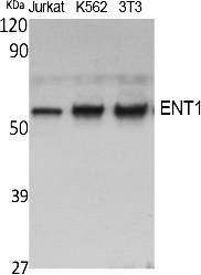 Fig. Western Blot analysis of extracts from Jurkat, K562,  NIH-3T3 cells, using ENT1 Polyclonal Antibody. Antibody was diluted at 1:2000. Secondary antibody (catalog#: A21020) was diluted at 1:20000.
