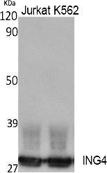 Fig. Western Blot analysis of extracts from Jurkat, K562 cells, using ING4 Polyclonal Antibody. Secondary antibody (catalog#: A21020) was diluted at 1:20000.