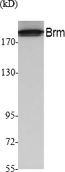 Fig. Western Blot analysis of extracts from A549 cells, using Brm Polyclonal Antibody. Secondary antibody (catalog#: A21020) was diluted at 1:20000.