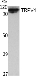 Fig. Western Blot analysis of extracts from K562 cells, using TRPV4 Polyclonal Antibody. Secondary antibody (catalog#: A21020) was diluted at 1:20000.