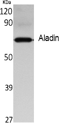 Fig. Western Blot analysis of extracts from rat kidney, using Aladin Polyclonal Antibody. Secondary antibody (catalog#: A21020) was diluted at 1:20000.
