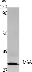 Fig. Western Blot analysis of extracts from rat stomach, using M6A Polyclonal Antibody. Secondary antibody (catalog#: A21020) was diluted at 1:20000.