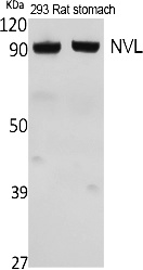 Fig. Western Blot analysis of extracts from rat stomach, 293 cells, using NVL Polyclonal Antibody. Secondary antibody (catalog#: A21020) was diluted at 1:20000.