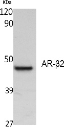 Fig. Western Blot analysis of extracts from K562 cells, using AR-β2 Polyclonal Antibody. Secondary antibody (catalog#: A21020) was diluted at 1:20000.
