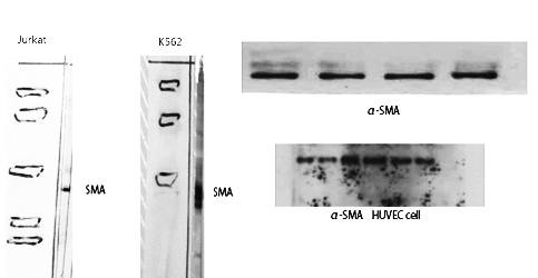 Fig. Western Blot analysis of various cells using α-SMA Polyclonal Antibody diluted at 1:500. Secondary antibody (catalog#: A21020) was diluted at 1:20000.
