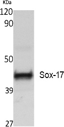 Fig. Western Blot analysis of extracts from Jurkat cells, using Sox-17 Polyclonal Antibody. Secondary antibody (catalog#: A21020) was diluted at 1:20000.