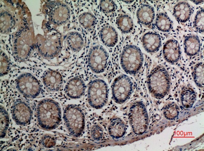 Fig.2. Immunohistochemical analysis of paraffin-embedded human-colon, antibody was diluted at 1:100.