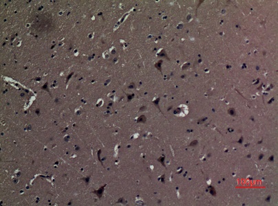 Fig.3. Immunohistochemical analysis of paraffin-embedded human-brain, antibody was diluted at 1:100.