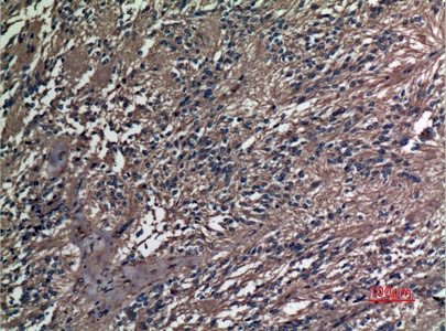 Fig.3. Immunohistochemical analysis of paraffin-embedded human-ovary, antibody was diluted at 1:100.