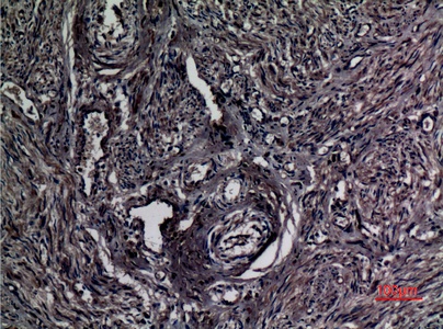 Fig.4. Immunohistochemical analysis of paraffin-embedded human-uterus, antibody was diluted at 1:100.