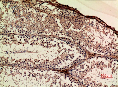 Fig.2. Immunohistochemical analysis of paraffin-embedded Mouse-ovary, antibody was diluted at 1:100.