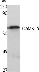 Fig.1. Western Blot analysis of extracts from K562 cells, using CaMKIIδ Polyclonal Antibody. Secondary antibody (catalog#: A21020) was diluted at 1:20000.