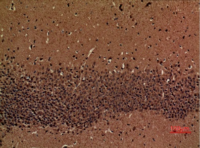 Fig.3. Immunohistochemical analysis of paraffin-embedded Mouse-brain, antibody was diluted at 1:100.