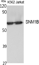 Fig. Western Blot analysis of extracts from K562,  Jurkat cells, using SNM1B Polyclonal Antibody. Secondary antibody (catalog#: A21020) was diluted at 1:20000.