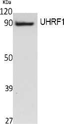 Fig. Western Blot analysis of extracts from Jurkat cells, using UHRF1 Polyclonal Antibody. Secondary antibody (catalog#: A21020) was diluted at 1:20000.