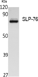 Fig.1. Western Blot analysis of extracts from Jurkat cells, using SLP-76 Polyclonal Antibody. Secondary antibody (catalog#: A21020) was diluted at 1:20000.