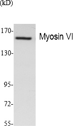 Fig.1. Western Blot analysis of extracts from Jurkat cells, using Myosin VI Polyclonal Antibody. Secondary antibody (catalog#: A21020) was diluted at 1:20000.