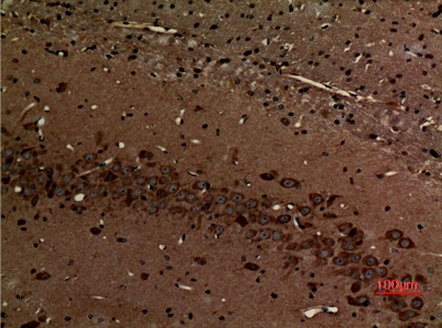 Fig.4. Immunohistochemical analysis of paraffin-embedded rat-brain, antibody was diluted at 1:100.
