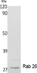 Fig.1. Western Blot analysis of extracts from K562 cells, using Rab 26 Polyclonal Antibody. Secondary antibody (catalog#: A21020) was diluted at 1:20000.