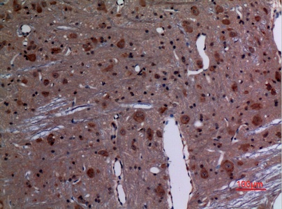 Fig.2. Immunohistochemical analysis of paraffin-embedded rat-brain, antibody was diluted at 1:100.