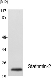 Fig.1. Western Blot analysis of extracts from Jurkat cells, using Stathmin-2 Polyclonal Antibody. Secondary antibody (catalog#: A21020) was diluted at 1:20000.