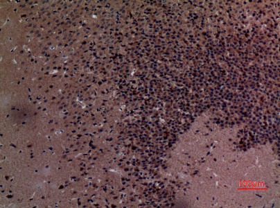 Fig.4. Immunohistochemical analysis of paraffin-embedded Mouse-brain, antibody was diluted at 1:100.