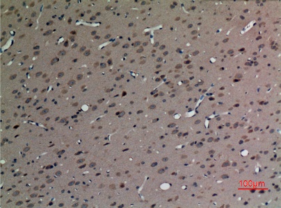 Fig.2. Immunohistochemical analysis of paraffin-embedded rat-brain, antibody was diluted at 1:100.