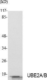 Fig.1. Western Blot analysis of extracts from Jurkat cells, using UBE2A/B Polyclonal Antibody. Secondary antibody (catalog#: A21020) was diluted at 1:20000.