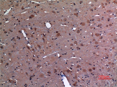 Fig.2. Immunohistochemical analysis of paraffin-embedded rat-brain, antibody was diluted at 1:100.