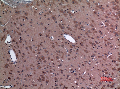 Fig.3. Immunohistochemical analysis of paraffin-embedded rat-brain, antibody was diluted at 1:100.