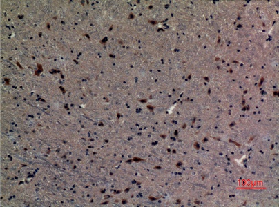 Fig.4. Immunohistochemical analysis of paraffin-embedded Mouse-brain, antibody was diluted at 1:100.
