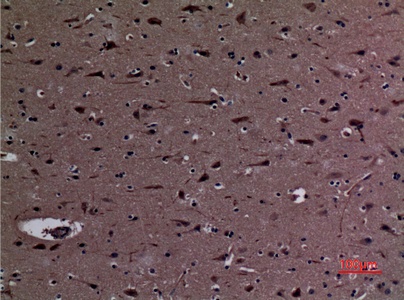 Fig.2. Immunohistochemical analysis of paraffin-embedded human-brain, antibody was diluted at 1:100.