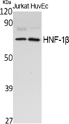 Fig. Western Blot analysis of extracts from Jurkat cells, using HNF-1β Polyclonal Antibody. Secondary antibody (catalog#: A21020) was diluted at 1:20000.