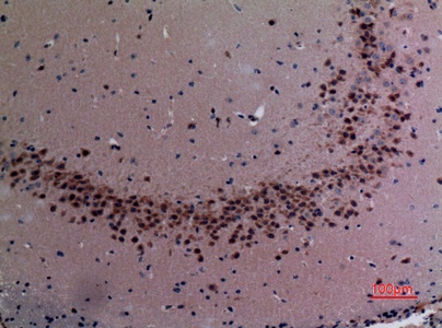 Fig.2. Immunohistochemical analysis of paraffin-embedded Mouse-brain, antibody was diluted at 1:100.