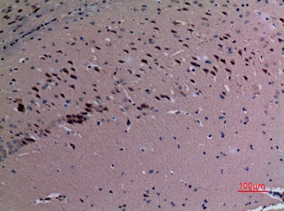 Fig.3. Immunohistochemical analysis of paraffin-embedded Mouse-brain, antibody was diluted at 1:100.