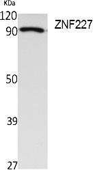 Fig.1. Western Blot analysis of extracts from Jurkat cells, using ZNF227 Polyclonal Antibody. Secondary antibody (catalog#: A21020) was diluted at 1:20000.