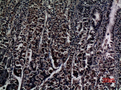 Fig.4. Immunohistochemical analysis of paraffin-embedded human-stomach, antibody was diluted at 1:100.
