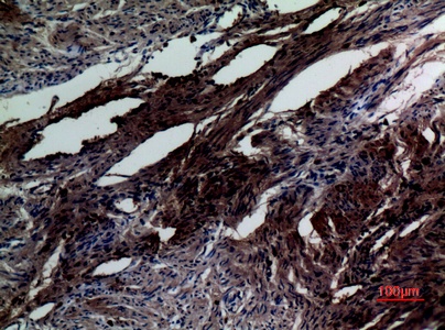 Fig.2. Immunohistochemical analysis of paraffin-embedded human-uterus, antibody was diluted at 1:100.