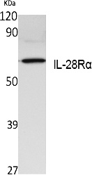 Fig. Western Blot analysis of extracts from K562 cells, using IL-28Rα Polyclonal Antibody. Secondary antibody (catalog#: A21020) was diluted at 1:20000.