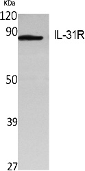 Fig. Western Blot analysis of extracts from Jurkat cells, using IL-31R Polyclonal Antibody. Secondary antibody (catalog#: A21020) was diluted at 1:20000.