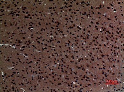 Fig.2. Immunohistochemical analysis of paraffin-embedded Mouse-brain, antibody was diluted at 1:100.
