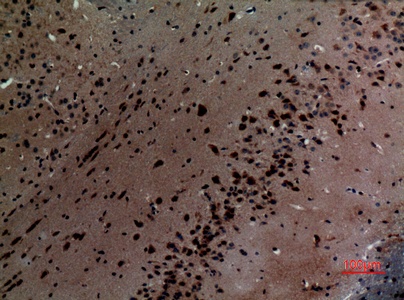 Fig.3. Immunohistochemical analysis of paraffin-embedded Mouse-brain, antibody was diluted at 1:100.