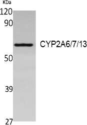 Fig. Western Blot analysis of extracts from Jurkat cells, using CYP2A6/7/13 Polyclonal Antibody. Secondary antibody (catalog#: A21020) was diluted at 1:20000.