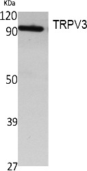 Fig.1. Western Blot analysis of extracts from Jurkat cells, using TRPV3 Polyclonal Antibody. Secondary antibody (catalog#: A21020) was diluted at 1:20000.